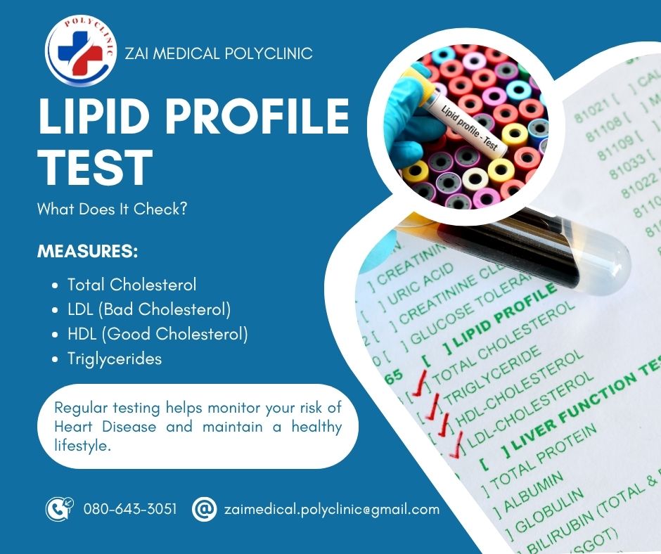 Lipid Profile Test